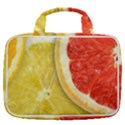 Fruit, Lemon Travel Toiletry Bag With Hanging Hook View2