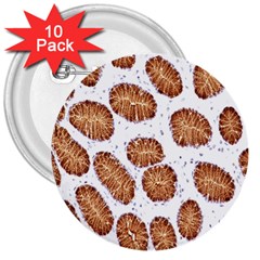 Formalin Paraffin Human Stomach Stained Bacteria Brown 3  Buttons (10 Pack)  by Mariart